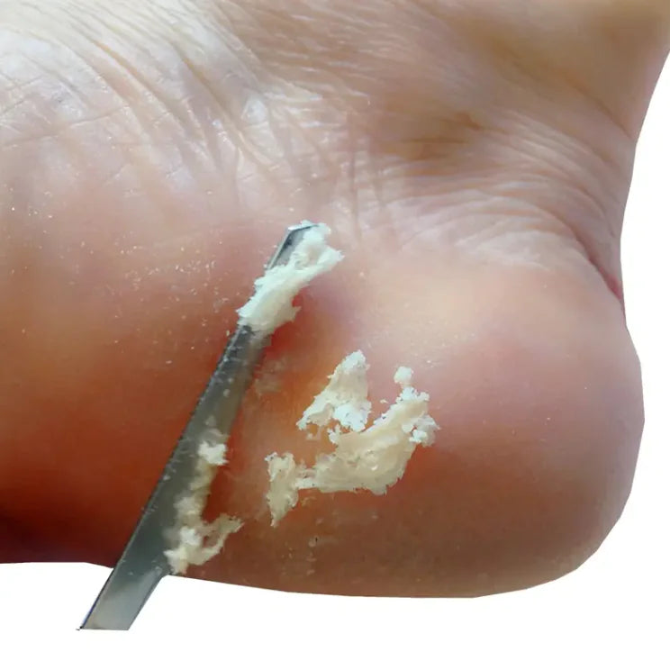 Professional Pedicure Knife and Heel Scraper Set