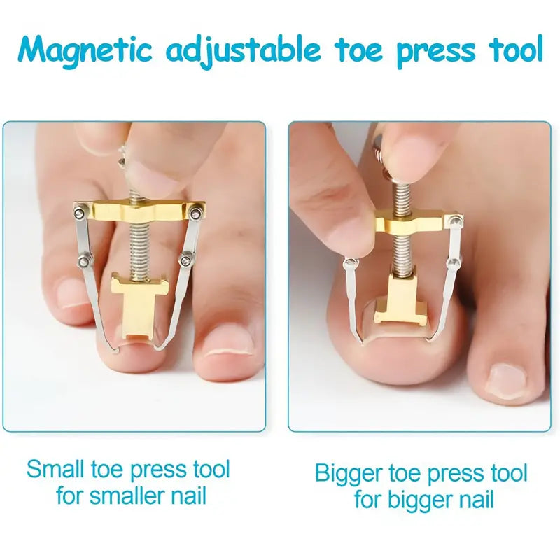 Ingrown Toenail Treatment Tool for Professional Pedicure