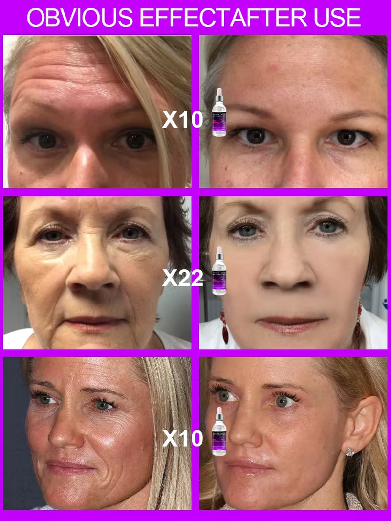 Retinol Facial Essence Moisturizing Firming, Rejuvenating Anti-Aging Makeup Skin Care Products