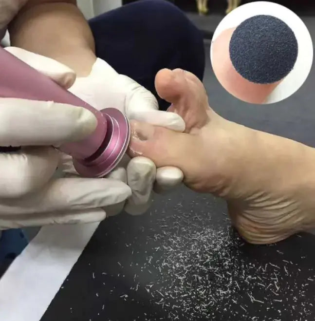 Electric Pedicure Foot Care Tool