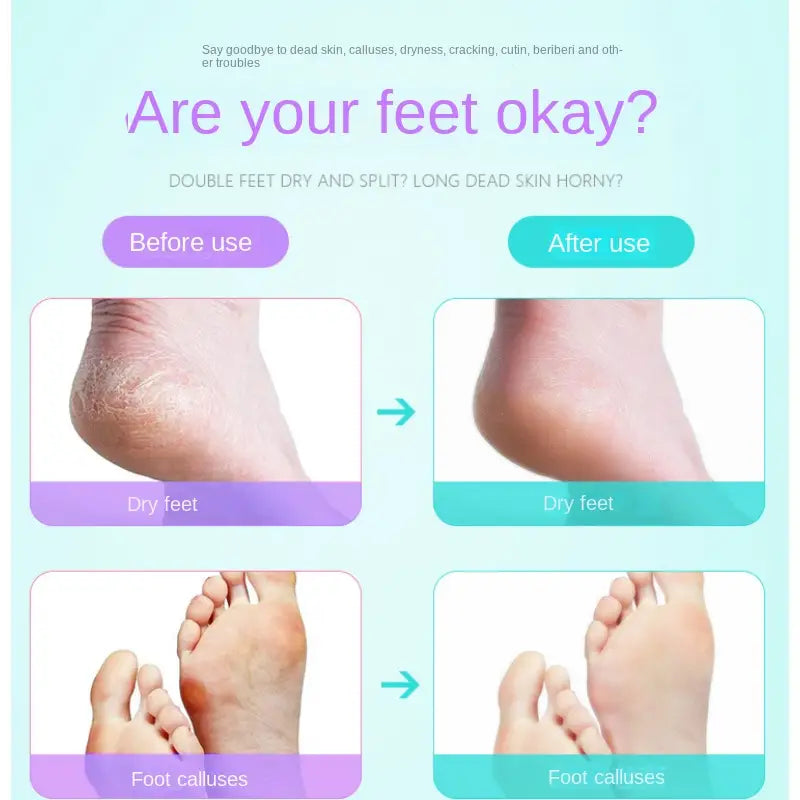 8-in-1 Pedicure Kit with Foot Files and Callus Remover